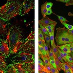 Mammary epithelial cells