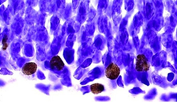 Neurons.