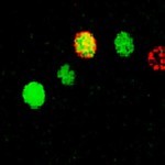 The researchers found that running prevents the activation of new neurons in response to stress.