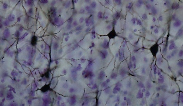 Golgi-stained neurons in the cortex (Wikipedia).