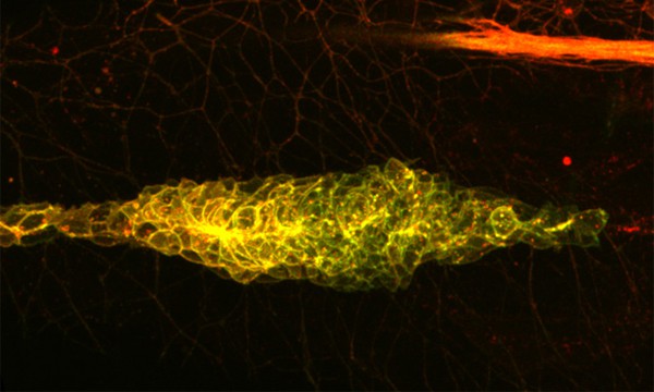 A mass of migrating cells in the zebrafish embryo keep to one direction by vacuuming up the path behind them (EMBL/E. Donà).