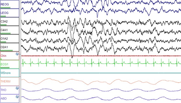 Deep sleep (Wikipedia).