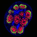 Grape-like structures of viral replication territories in the nucleus of a human cell