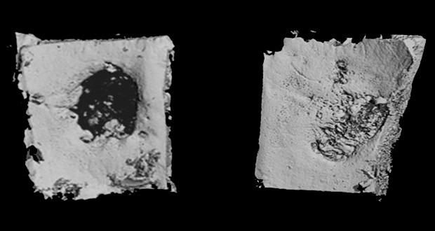 The patch nearly fully regrowing missing skull (Satheesh Elangovan).