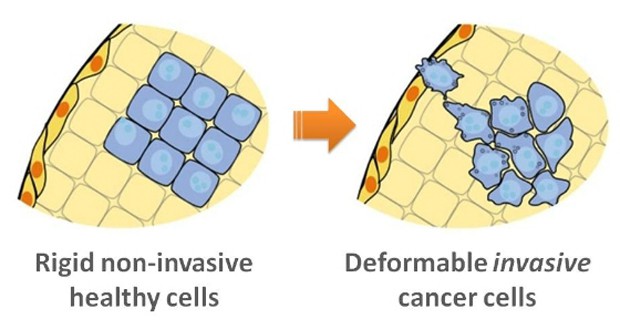 A transition to invasive malignant cells in a tumor is associated with the cell's increased ability to stretch, which may allow for invasion through tight tissue junctions (UCLA).