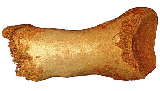 See image 1.