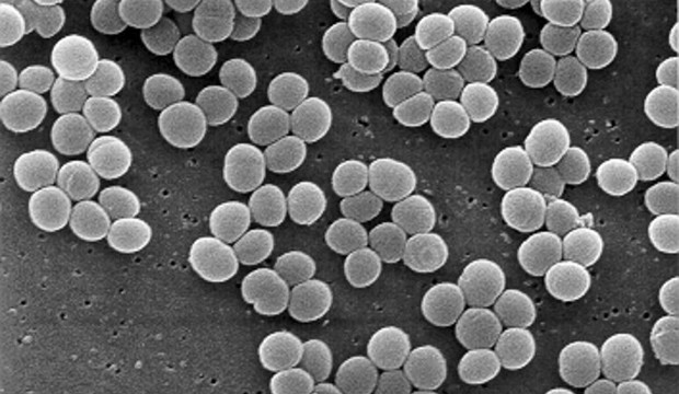 Staphylococcus aureus (Wikipedia).
