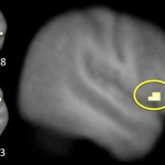 Activity in the right inferior frontal gyrus (yellow) shifted from during control (reactive) to before control (proactive).