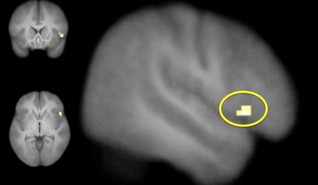 See image 1.