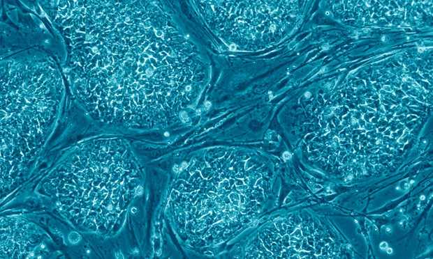 Stem cell colonies (Wikipedia).