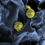 Scanning electron microscopy of stem cells (yellow / green) in a scaffold structure (blue) serving as a basis for the artificial bone marrow (C. Lee-Thedieck, KIT).