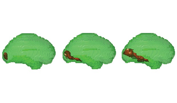 MIT researchers combined fMRI and MEG