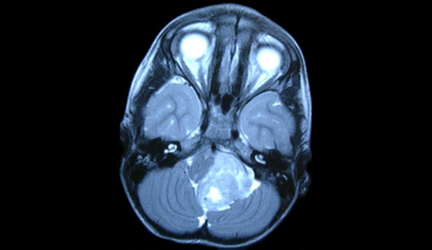 Image by dkfz.de.