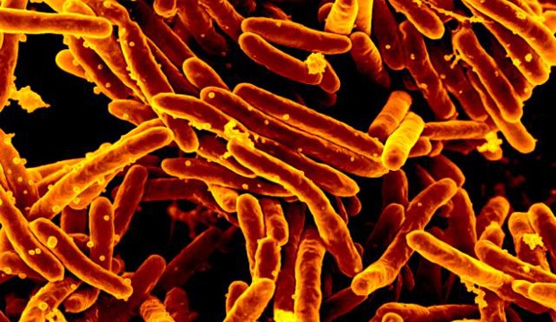 Scanning electron micrograph of Mycobacterium tuberculosis bacteria, which causes tuberculosis (Wikimedia Commons).