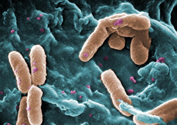 Pseudomonas aeruginosa (Wikimedia).