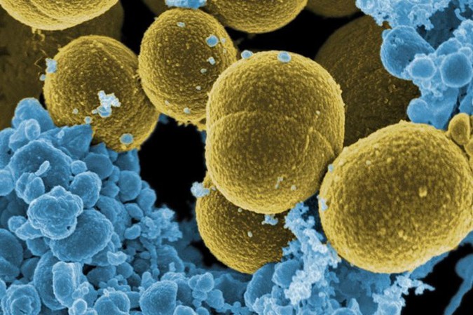 S. aureus bacteria and human white blood cells (NIH).