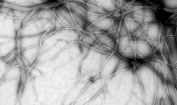 Prion fibrils (Flickr).