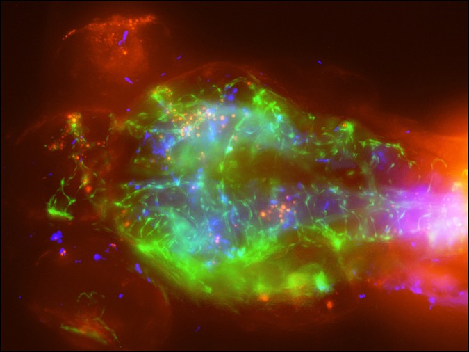 Zebrafish larva infected with Cryptococcal meningitis and photographed under a microscope. Stefan Oehlers/Duke Medicine