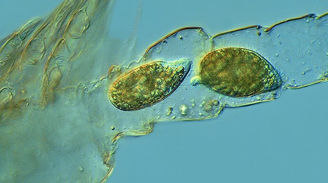 TETRAHYMENA EN EL LABERINTO (Proyecto Agua, Flickr).