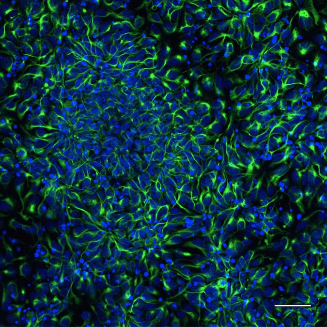 Human neuron progenitors express neural stem cell marker Nestin (green). Image courtesy of Danielle Feldman, Sur laboratory, Picower Institute at MIT.