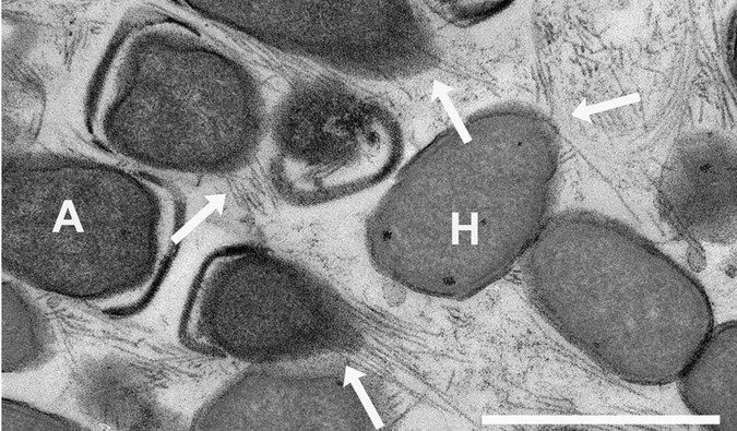 Electron micrograph of the nanowires connecting archaea and sulphate reducing bacteria.
