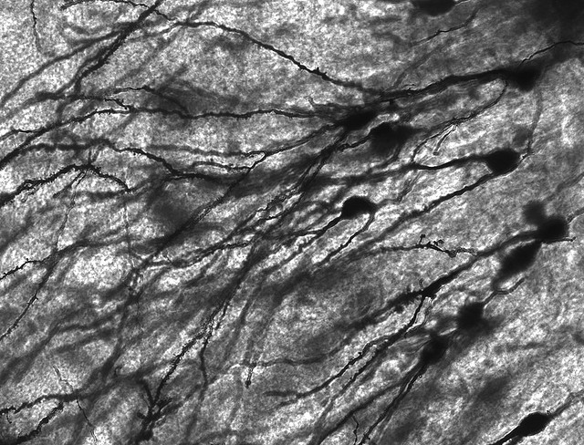 Gyrus Dentatus 40x (Roxana, Flickr).