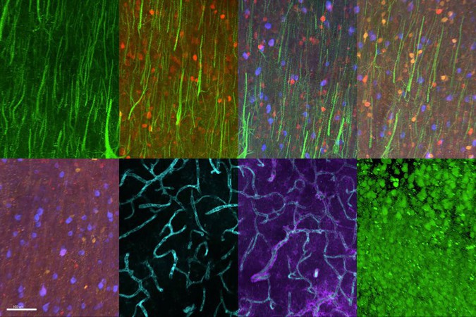 MIT-Protein-Imaging.jpg