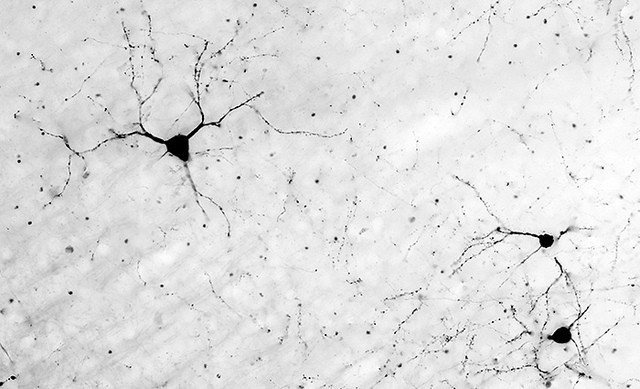 Neurons-in-the-brain (Bryan Jones, Flickr).