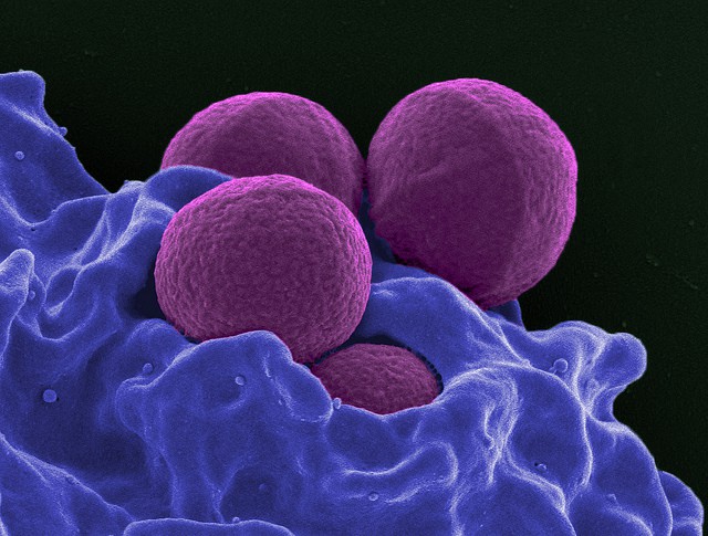 mrsa.jpg