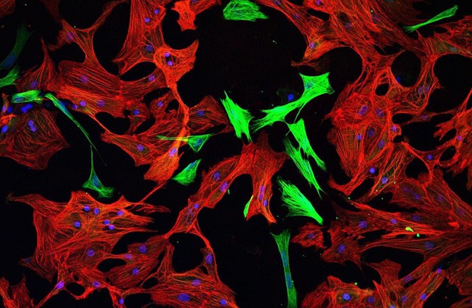 heartcells.jpg