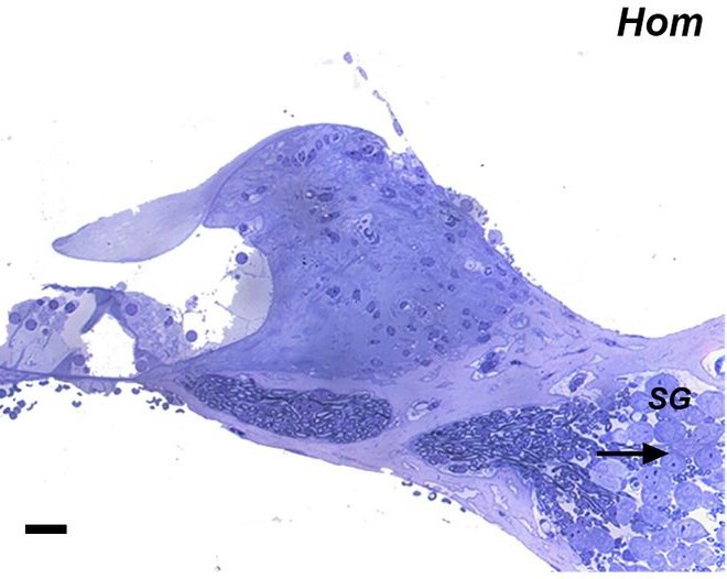 hearinggene.jpg