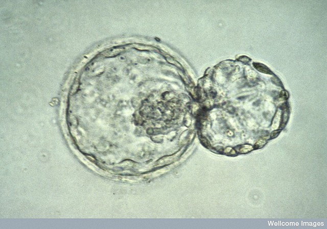 blastocyst.jpg
