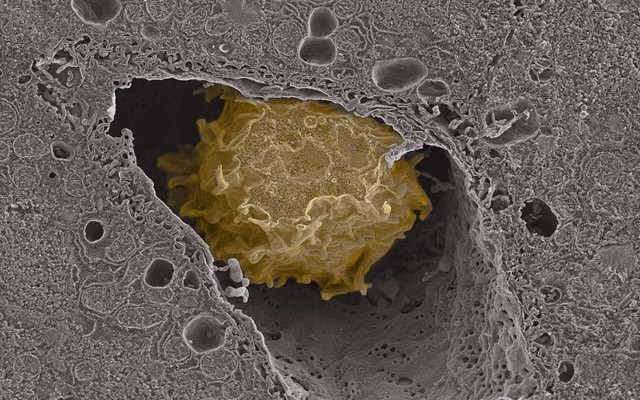 macrophage.jpg