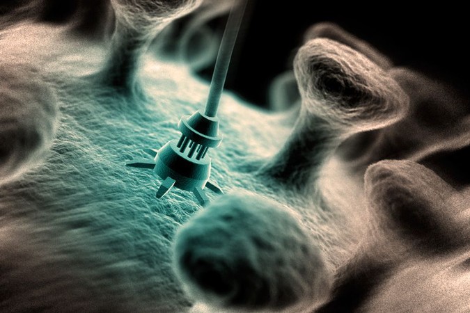 MIT-MicroMotion.jpg