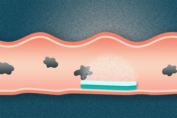 MIT-GI-tract-drug-delivery.jpg