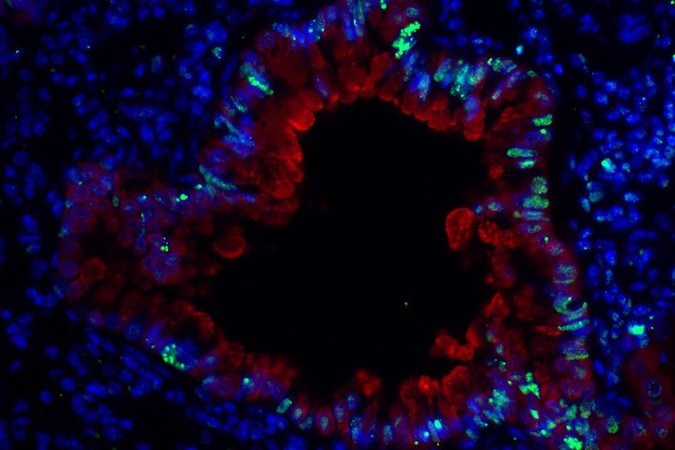 MIT-Asthma-DNA.jpg