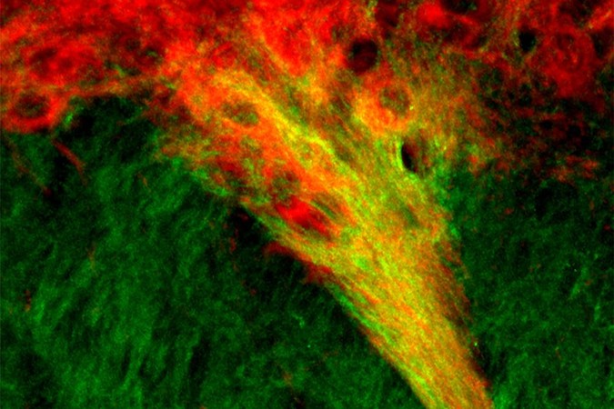 MIT-Dopamine-Systems-1.jpg
