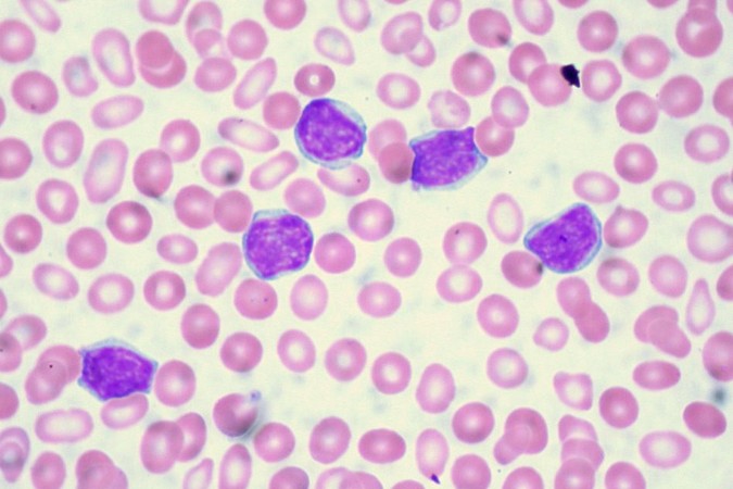MIT-Cancer-Cell-Mass-1.jpg