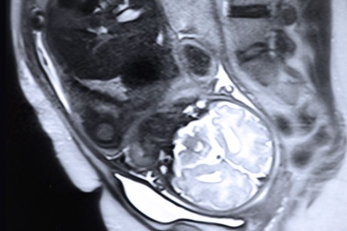MIT-Fetal-MRI.jpg