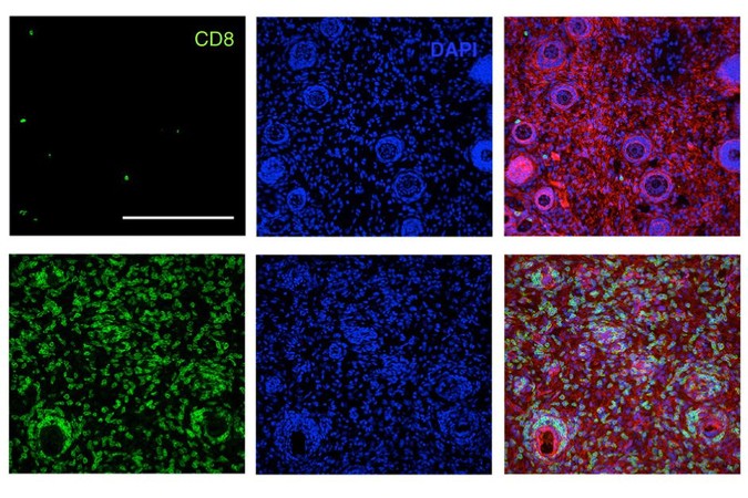 MIT-Immunotherapy-1.jpg