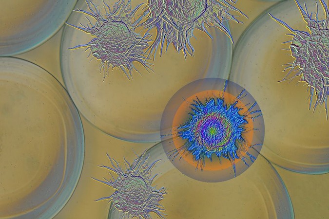 MIT-Prevent-Fibrosis.jpg