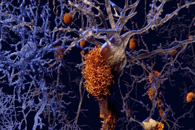 MIT-Amyloid-Protein.jpg