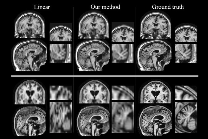 MIT-Better-MRI.jpg