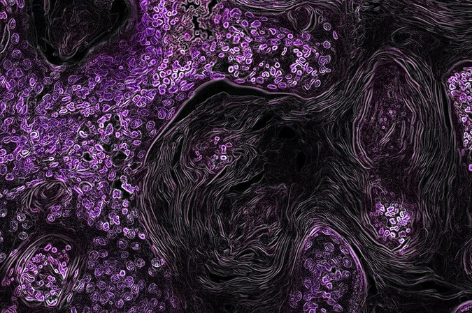 MIT-Lung-Cancer-Target-01.jpg