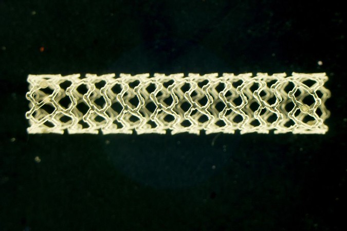 MIT-Stent-Failure.jpg