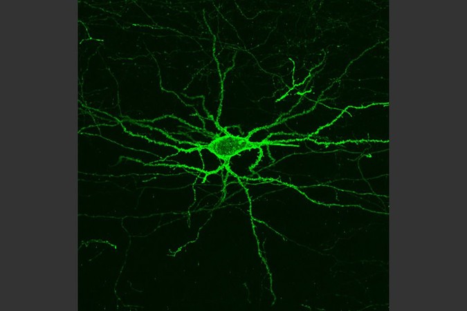 MIT-Voltage-Imaging.jpg