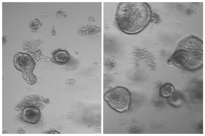 MIT-Stem-Cell-Diet.jpg