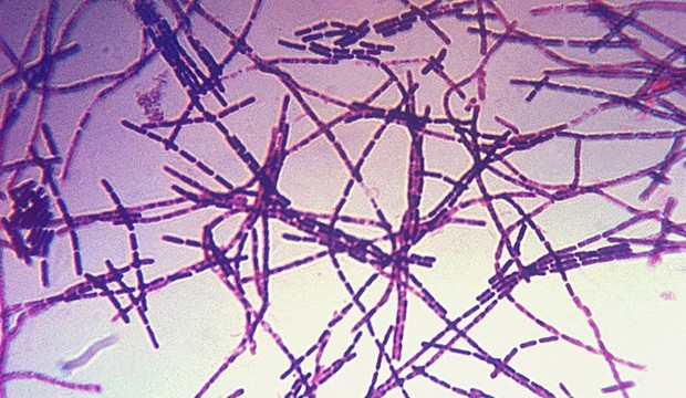 Bacillus_anthracis_1.jpg
