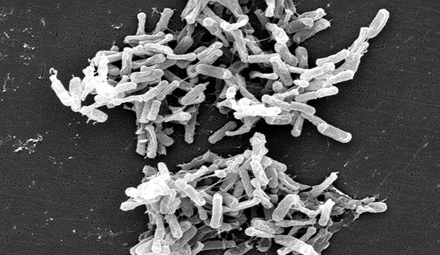 Clostridium_difficile_1_wikipedia.jpg