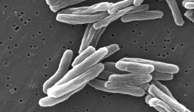 Mycobacterium_tuberculosis_cover.jpg